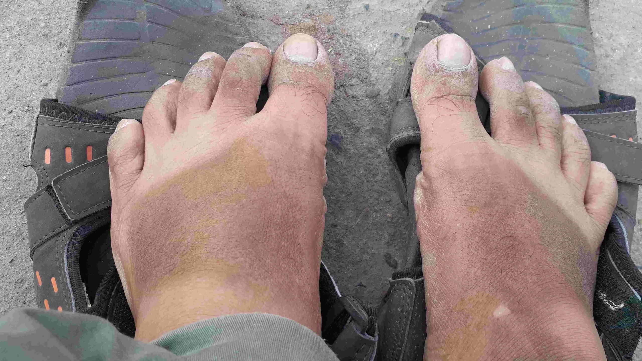 This is what fly ash did to the feet of Gaon Connection reporter when he visited the area near coal-mines